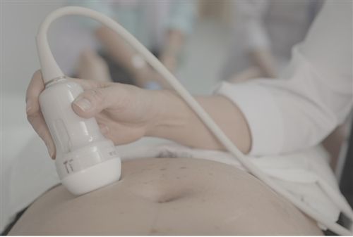 Ruột tăng âm - Bệnh viện Từ Dũ