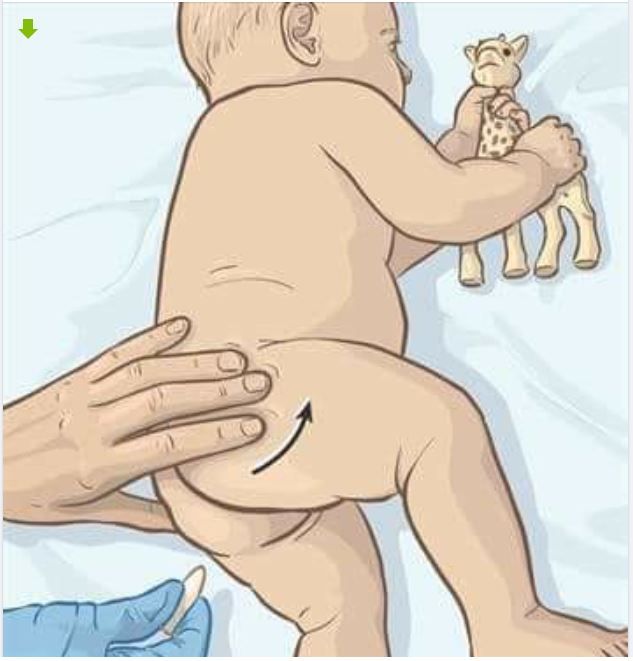 Cách đặt thuốc hạ sốt qua đường hậu môn cho trẻ