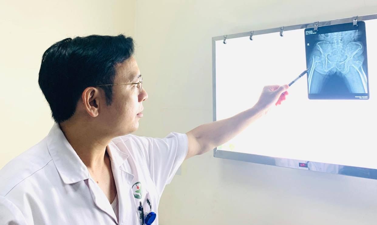 Cách phòng ngừa gãy xương vùng khớp háng ở người cao tuổi - Bệnh viện Việt Đức