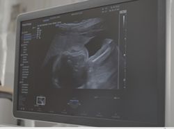 Nốt vôi hóa trong gan - Bệnh viện Từ Dũ