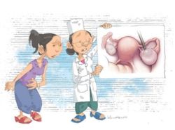 U nang buồng trứng