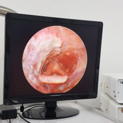 Suy kiệt thể trạng do viêm loét họng - Bệnh viện 108
