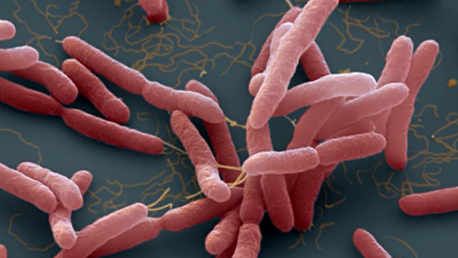 Bệnh Melioidosis (Bệnh Whitmore) - Bệnh viện 108
