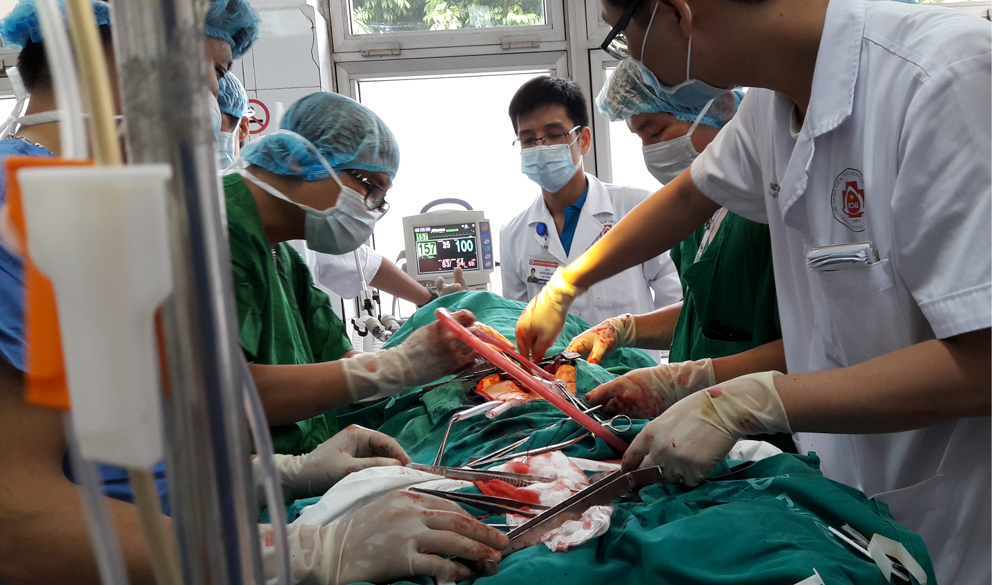 Tiến hành phẫu thuật tim hở do chấn thương tim - Bệnh viện 108