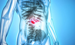 Ung thư tụy gây tử vong nhanh - Bệnh viện Việt Đức