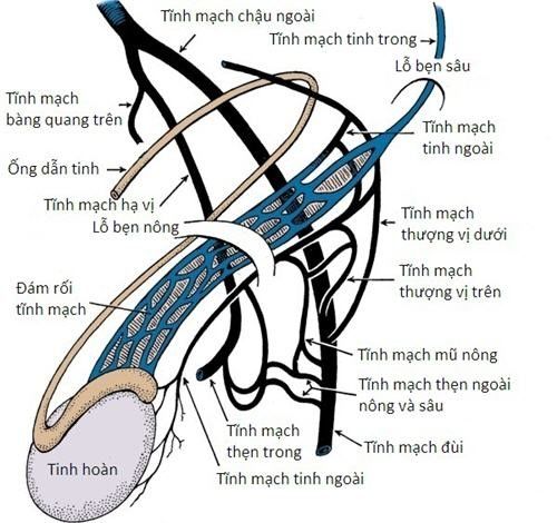 Siêu âm trong giãn tĩnh mạch thừng tinh - Bệnh viện 108