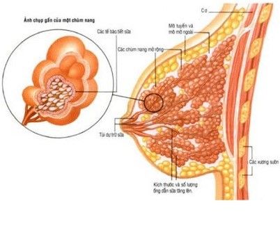 Một số điều cần biết về viêm tắc tia sữa - Bệnh viện 108