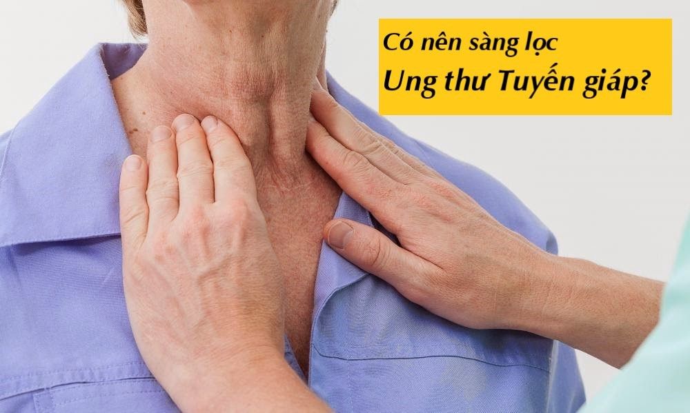 Có nên sàng lọc ung thư tuyến giáp? Những hiểu biết về ung thư tuyến giáp - Bệnh viện 108
