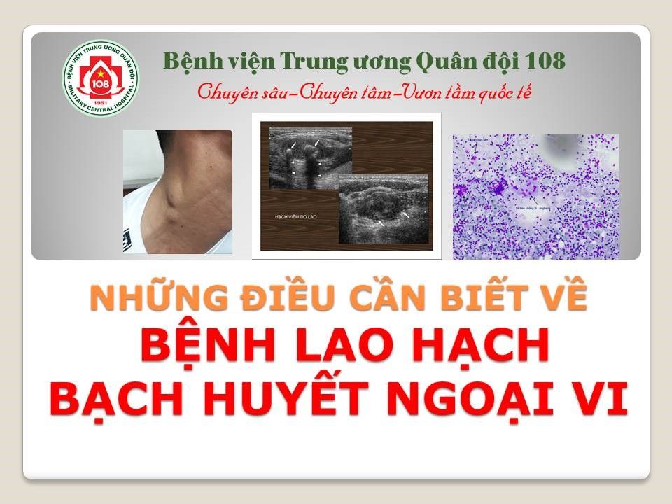 Những điều cần biết về bệnh lao hạch bạch huyết ngoại vi - Bệnh viện 108