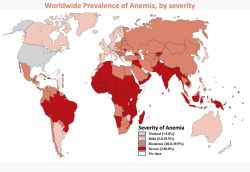 Thiếu máu - thường gặp nhưng hay bị bỏ qua! - Bệnh viện 108