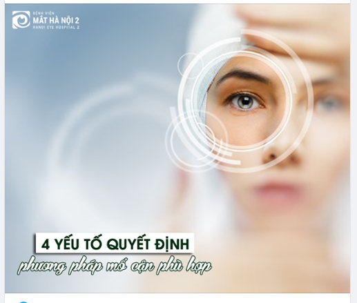 4 YẾU TỐ QUYẾT ĐỊNH PHƯƠNG PHÁP MỔ CẬN PHÙ HỢP