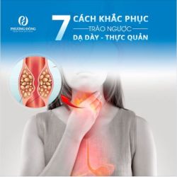 7 cách khắc phục trào ngược dạ dày, thực quản