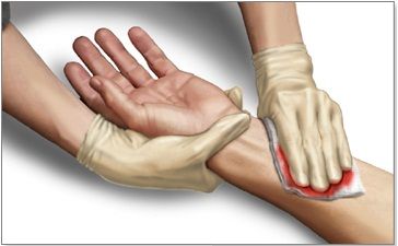 Khi chứng kiến tai nạn ô tô có nhiều người thương vong, bạn cần làm gì để có cơ hội cứu được nhiều người trước khi đội cứu hộ có mặt- Bệnh Viện Việt Đức