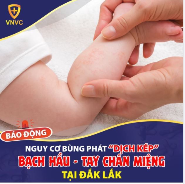 BÁO ĐỘNG ĐỎ NGUY CƠ BÙNG PHÁT “DỊCH KÉP” BẠCH HẦU - TAY CHÂN MIỆNG TẠI ĐẮK LẮK