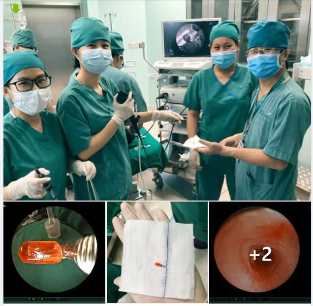 BÉ 10 THÁNG NGẬM RỒI HÓC "ĐẦU ĐÈN LED" ĐIỆN THOẠI ĐỒ CHƠI VÔ PHỔI..