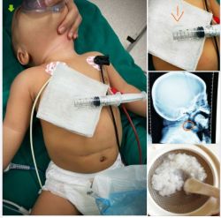 ĐANG ĂN DẶM CHÁO MẸ RÂY, BÉ HỐT HOẢNG BỎ ĂN VÀ QUẤY KHÓC LIÊN TỤC..