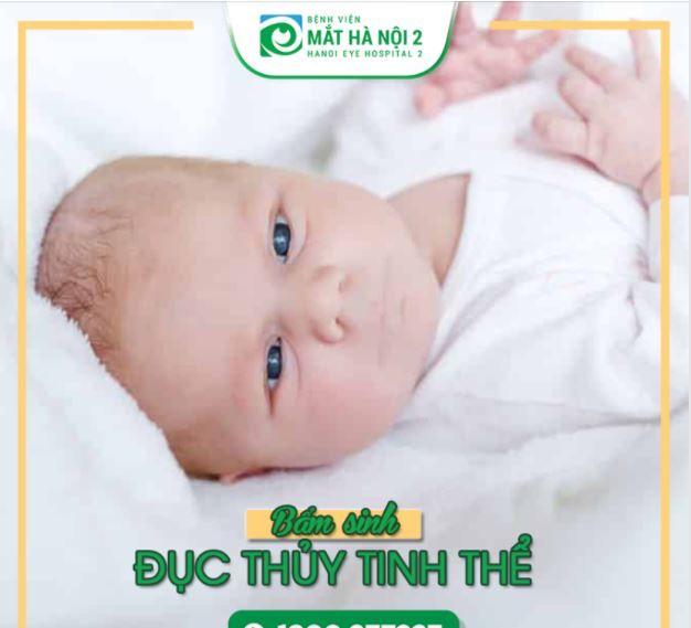 BỆNH ĐỤC THỦY TINH THỂ BẨM SINH