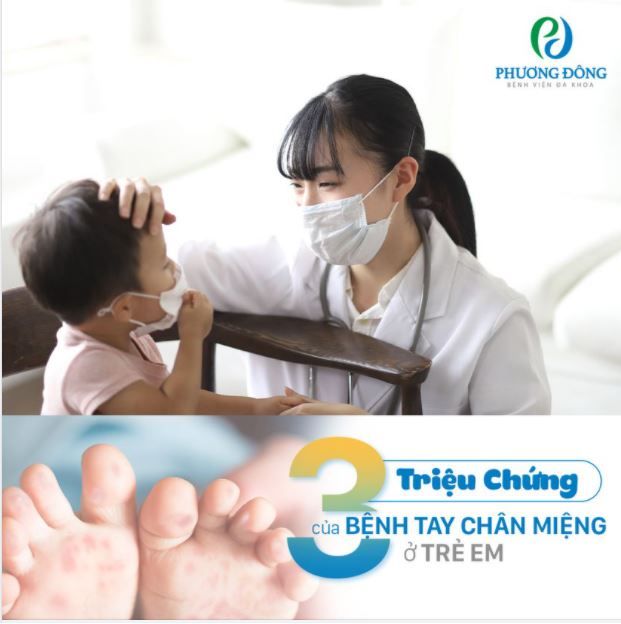 3 TRIỆU CHỨNG BỆNH TAY CHÂN MIỆNG Ở TRẺ EM