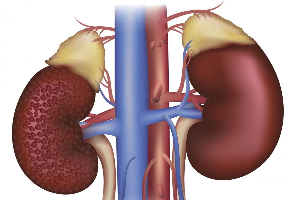 Bệnh thận đái tháo đường: Những lời khuyên hữu ích từ chuyên gia - Bệnh viện Việt Đức
