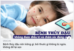 BỆNH THỦY ĐẬU: SAI LẦM TRONG ĐIỀU TRỊ CÓ THỂ DẪN ĐẾN BIẾN CHỨNG. NÊN KIÊNG GÌ, BÔI THUỐC GÌ ĐỂ NHANH KHỎI VÀ KHÔNG ĐỂ LẠI SẸO?