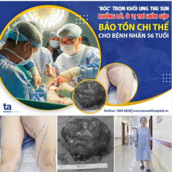 BỊ UNG THƯ SỤN, NỮ BỆNH NHÂN 56 TUỔI VUI MỪNG THOÁT NGUY CƠ CẮT CỤT CHI, BẢO TOÀN SỨC KHỎE SAU PHẪU THUẬT CẮT BỎ KHỐI UNG THƯ TẾ BÀO SỤN KÍCH THƯỚC KHỔNG LỒ Ở VỊ TRÍ HIẾM GẶP.