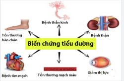 Biến chứng nguy hiểm của bệnh tiểu đường