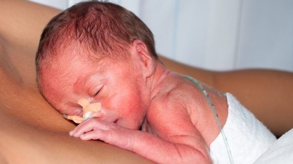 Hướng dẫn chăm sóc trẻ sơ sinh bằng phương pháp Kangaroo - Bệnh viện nhi Trung Ương