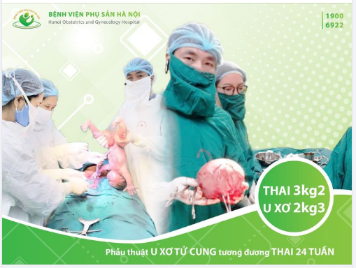 Bụng to nhanh nhưng không đi khám, người phụ nữ có khối u xơ tử cung tương đương thai 24 tuần
