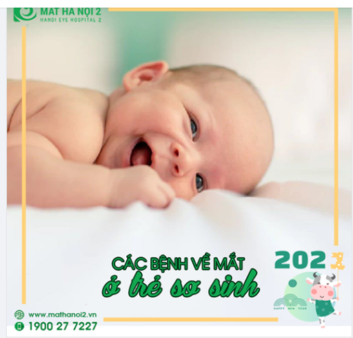 CÁC BỆNH VỀ MẮT Ở TRẺ SƠ SINH