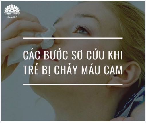 CÁC BƯỚC SƠ CẤP CỨU KHI TRẺ BỊ CHẢY MÁU CAM