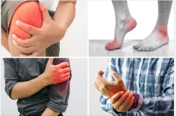 CÁCH ĐỐI PHÓ VỚI ĐAU KHỚP MÙA LẠNH