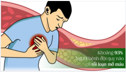 CÁCH PHÒNG TRÁNH NGUY CƠ ĐỘT QUỴ DO RỐI LOẠN MỠ MÁU BẠN CÓ BIẾT