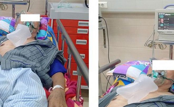 Cảnh báo điều trị tăng huyết áp, đái tháo đường không dùng thuốc - Bệnh viện 108