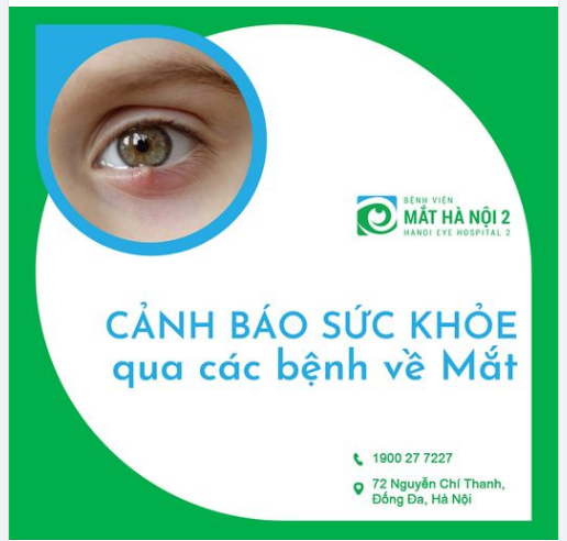 CẢNH BÁO SỨC KHỎE QUA CÁC BỆNH VỀ MẮT