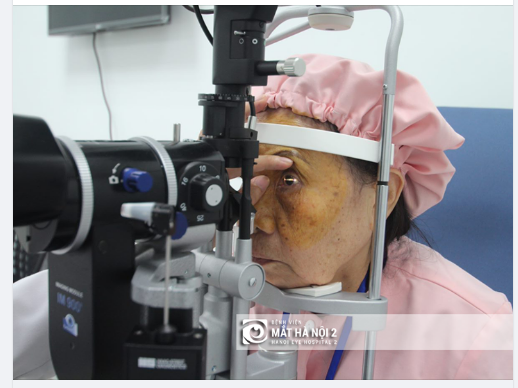 CHĂM SÓC MẮT SAU PHẪU THUẬT PHACO ĐIỀU TRỊ ĐỤC THỦY TINH THỂ