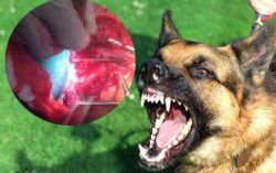 Bé trai 2 tuổi bị chó béc giê cắn rạn sọ, lòi nhãn cầu - Bệnh viện Việt Đức