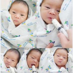 Hai tuần chào đời rồi mà làm gì được biết đến mùi sữa, bởi con mắc tật tim bẩm sinh quá phũ phàng: Chuyển vị đại động mạch (TGA)..