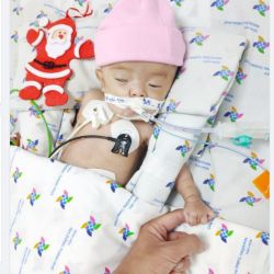 Cô bé tí hon tốt nghiệp lớp sinh non được dăm ba ngày thì vừa về nhà bị sặc sữa