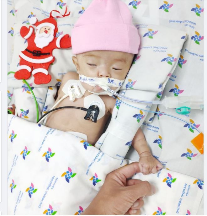 Cô bé tí hon tốt nghiệp lớp sinh non được dăm ba ngày thì vừa về nhà bị sặc sữa