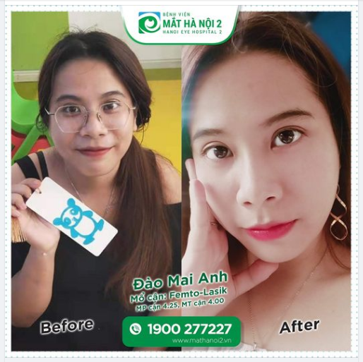 CỬ NHÂN NGOẠI GIAO TỰ TIN THỂ HIỆN BẢN THÂN SAU THÁO KÍNH