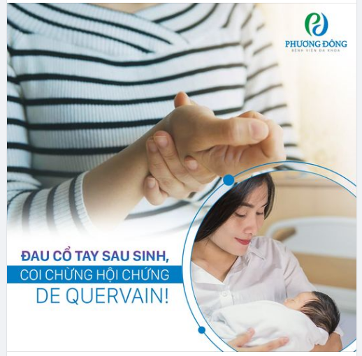 ĐAU CỔ TAY SAU SINH, COI CHỪNG HỘI CHỨNG DE QUERVAIN