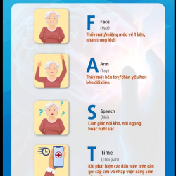 DẤU HIỆU CẢNH BÁO ĐỘT QUỴ ĐỪNG BỎ QUA QUY TẮC FAST