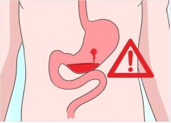 ĐỪNG PHỚT LỜ NHỮNG DẤU HIỆU CẢNH BÁO XUẤT HUYẾT DẠ DÀY DƯỚI ĐÂY