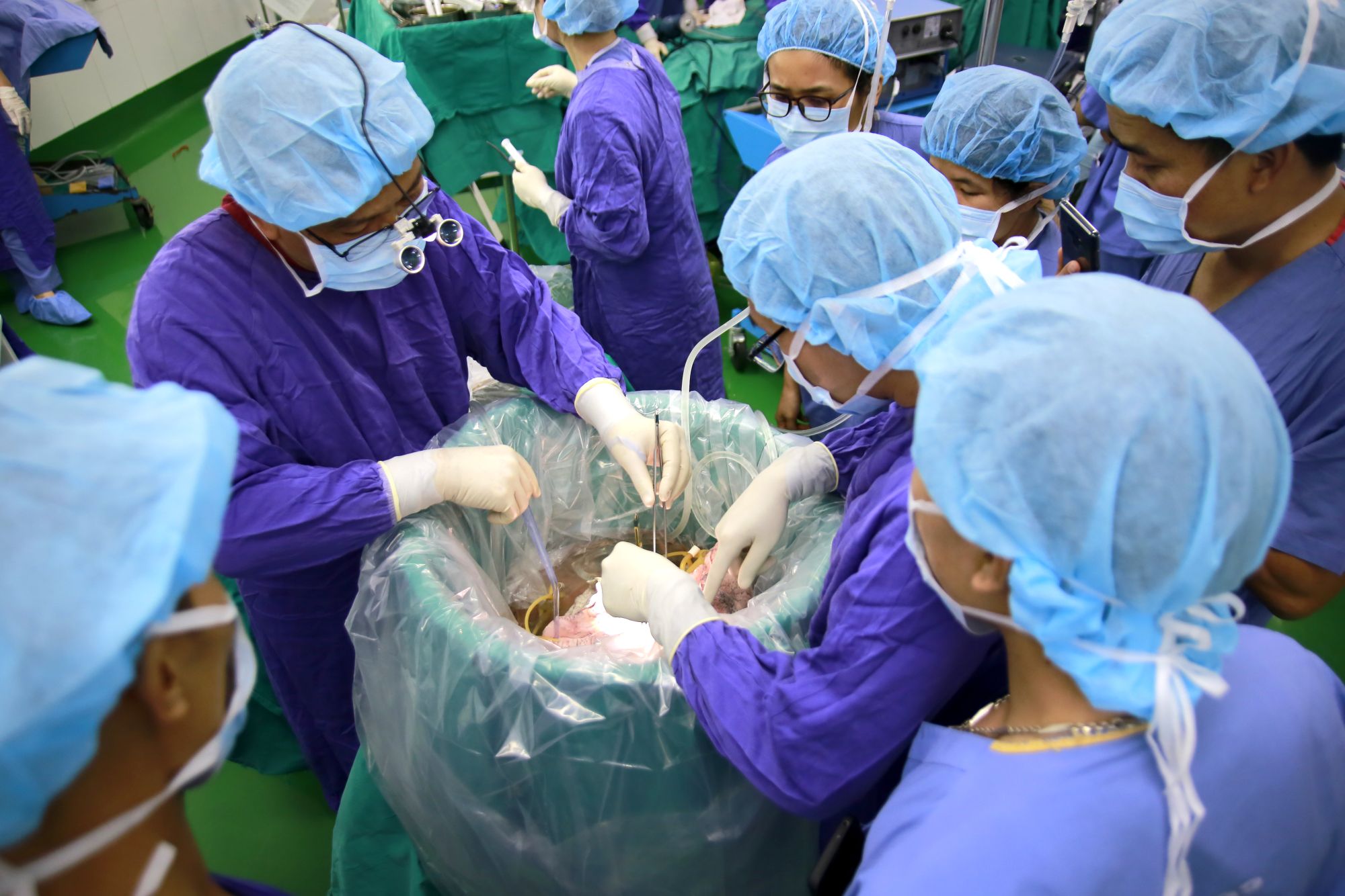 Lần đầu tiên Việt Nam ghép phổi thành công cho bệnh nhân mắc phổi mô kẽ - Bệnh viện Việt Đức