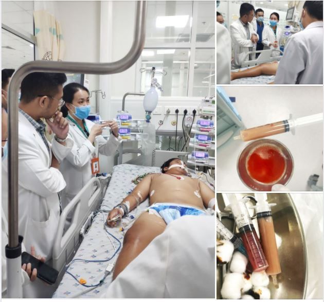 Diễn tiến nặng không kém Bệnh Whitmore, do trực khuẩn Burkholderia Pseudomallei (hay gọi là vi khuẩn ăn thịt người) gây ra