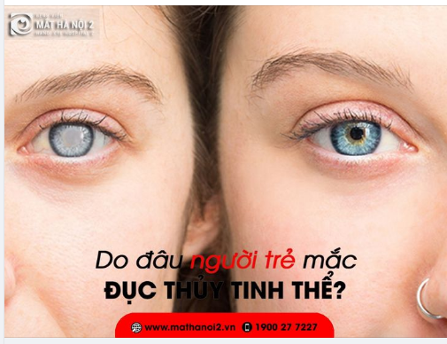 ĐỤC THỦY TINH THỂ Ở NGƯỜI TRẺ DO ĐÂU?