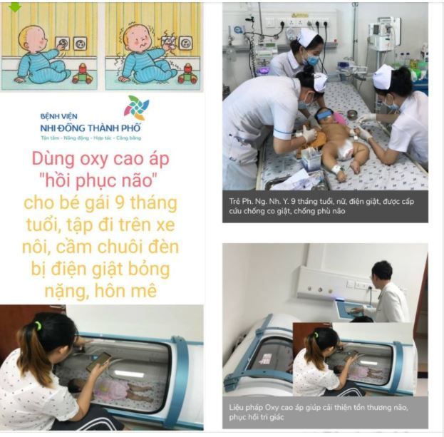 DÙNG "LỒNG OXY CAO ÁP" "HỒI PHỤC NÃO" CHO BÉ GÁI 9 THÁNG TUỔI, ĐANG TẬP ĐI XE NÔI, CẦM CHUÔI ĐÈN, BỊ ĐIỆN GIẬT BỎNG NẶNG, HÔN MÊ