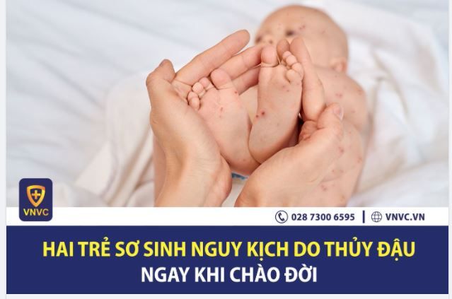 MẮC THỦY ĐẬU NGAY KHI CHÀO ĐỜI, HAI TRẺ SƠ SINH TẠI NGHỆ AN VÀ HÀ TĨNH NGUY KỊCH