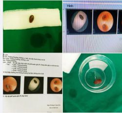 " Dự vị còn sót lại " của ngày Tết
