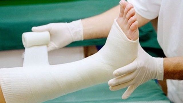 Hướng dẫn chăm sóc trẻ bó bột tại nhà - Bệnh viện nhi Trung Ương